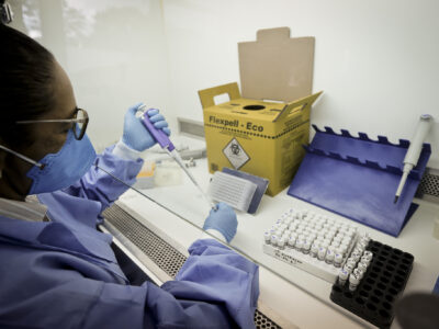 DF tem 29 casos importados de malária em 2025